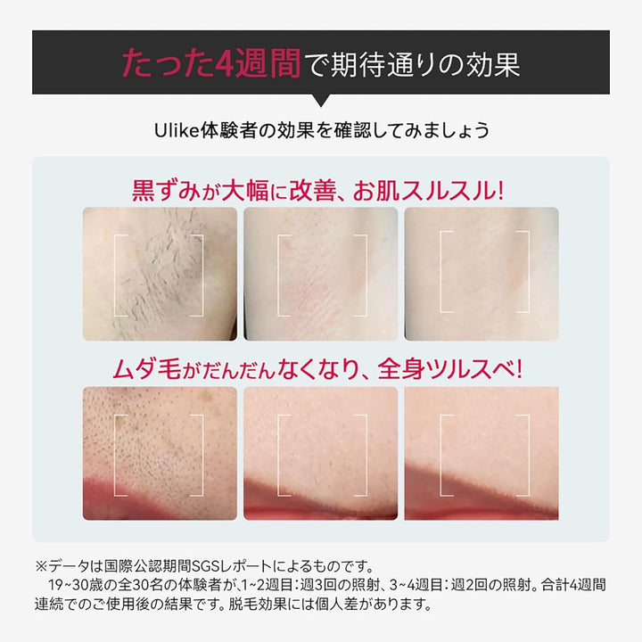 月額5,380円レンタルプラン:Ulike ユーライク 脱毛器 Air Pro UI04CJP ダークグリーン