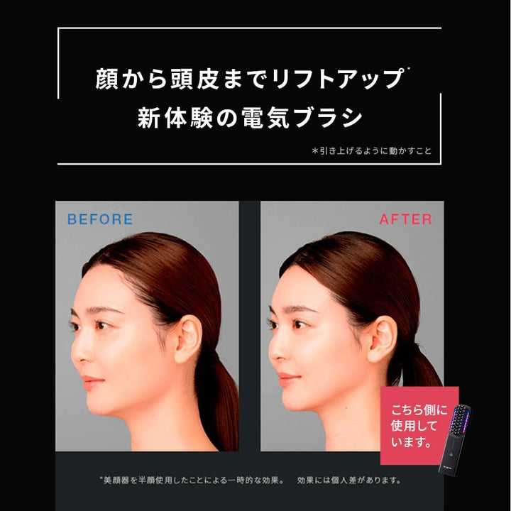 月額5,380円レンタルプラン:Brighte ELEKI BRUSH EMS 佐々木希愛用 リフトケア ヘッドスパ 頭ケア 頭皮ケア インテリジェントRF ホームエステ BRT-FS145 ブラック