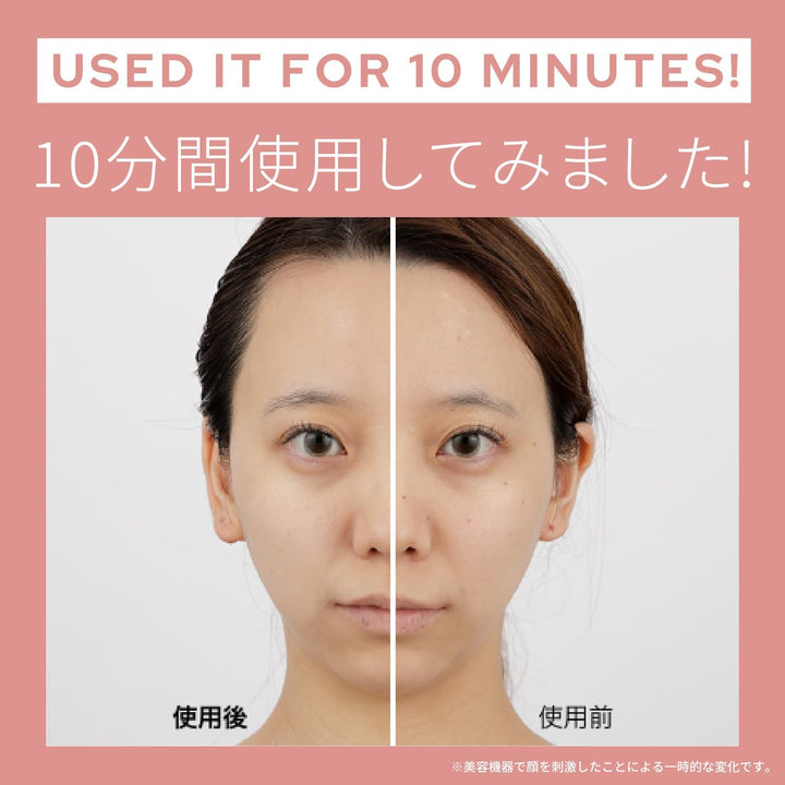 月額5,680円レンタルプラン:ヤーマン ミーゼ スカルプリフトアクティブ プラス EMS 美顔器 フェイスケア 美肌  リフトケア 防水 MS82G グレー