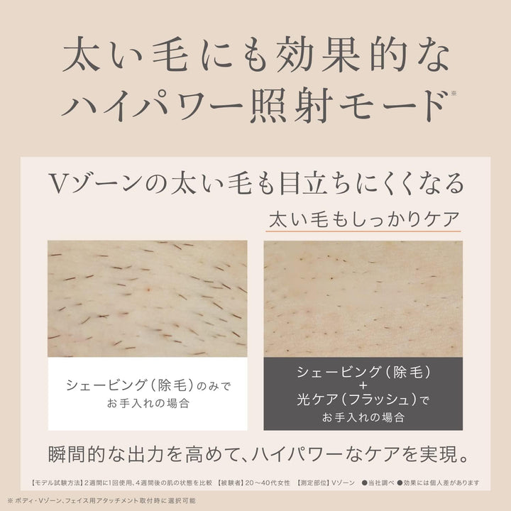 月額15,800円レンタルプラン:Panasonic(パナソニック) 光美容器セット (ES-WP87-N・ES-WP98-N)