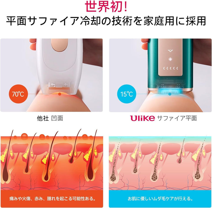 月額5,380円レンタルプラン:Ulike ユーライク 脱毛器 Air Pro UI04CJP ダークグリーン