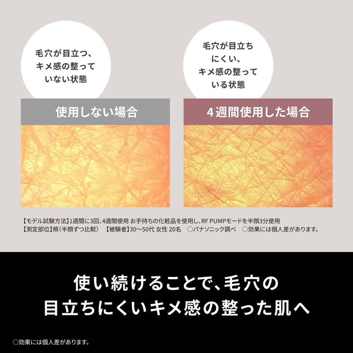 月額11,800円レンタルプラン:パナソニック 美顔器 エイジングケア バイタリフトRF EX EH-SR86-T ブラウン