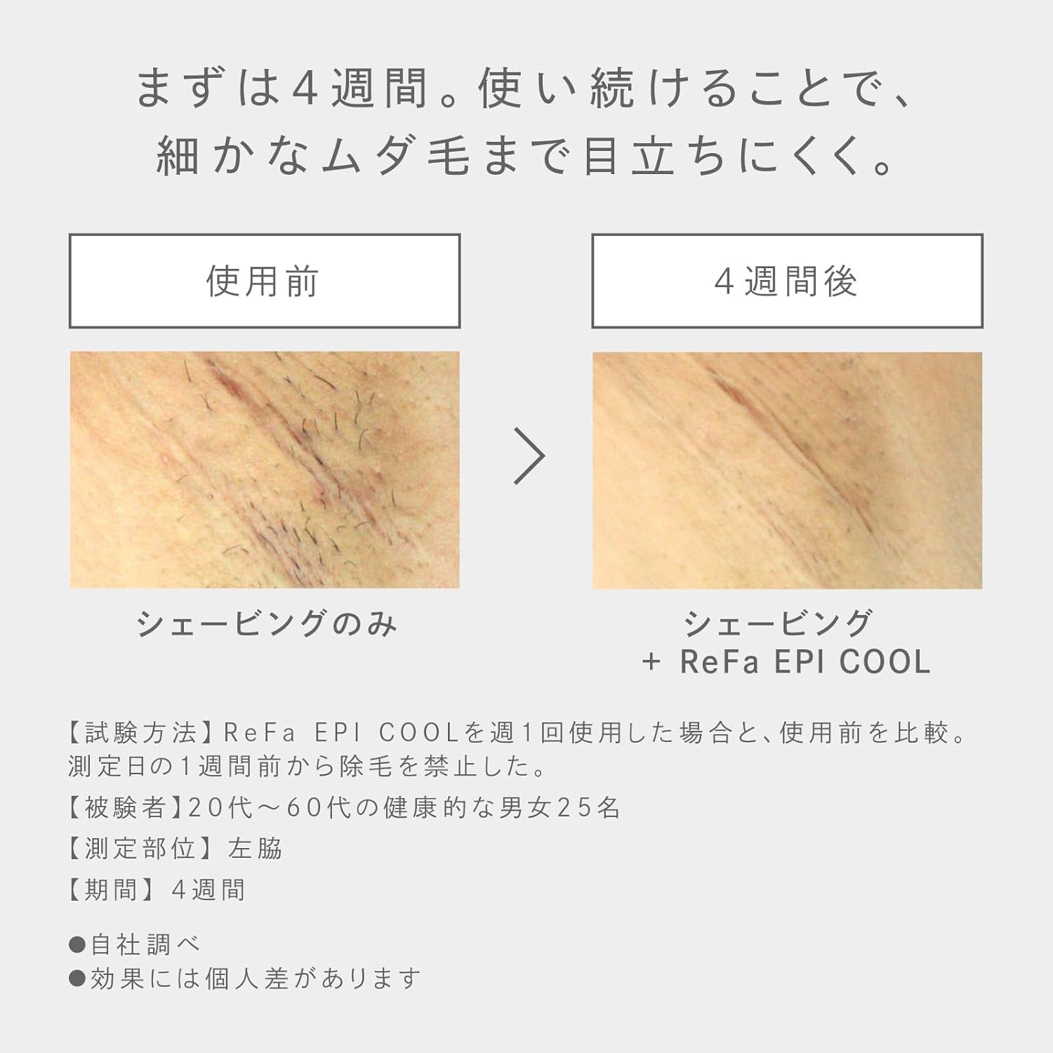 月額10,800円レンタルプラン：ReFa EPI COOL RE-BD-02A ホワイト – GYMGATE