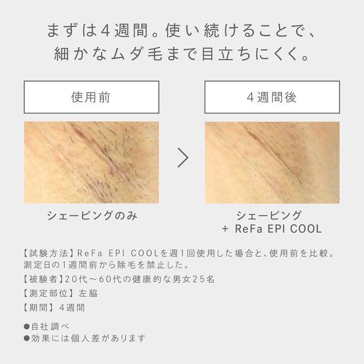月額10,800円レンタルプラン：ReFa EPI COOL RE-BD-02A ホワイト