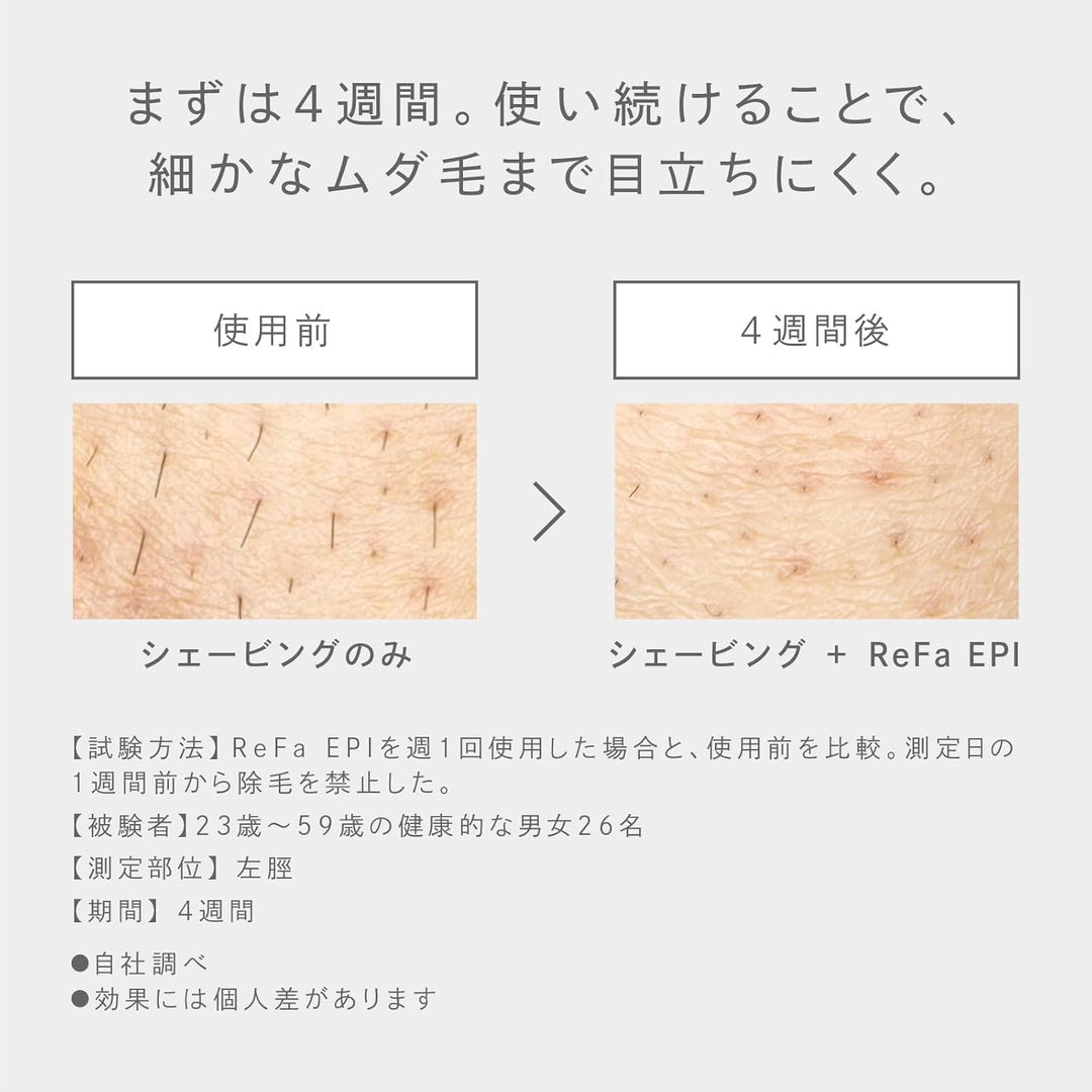 月額5,980円レンタルプラン：ReFa EPI RE-BA-00A ホワイト