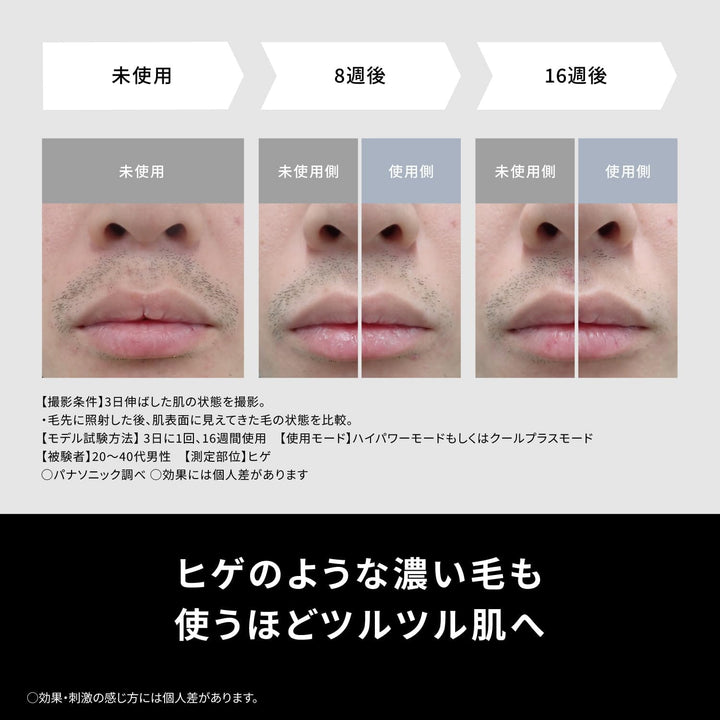 月額18,800円レンタルプラン：パナソニック スムースエピ パワー＆クール 脱毛器 ES-WG0B-H グレー