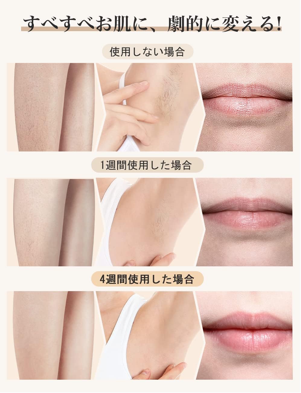 月額2,980円レンタルプラン：BIZINN IPL光脱毛器 D-1103 ホワイト