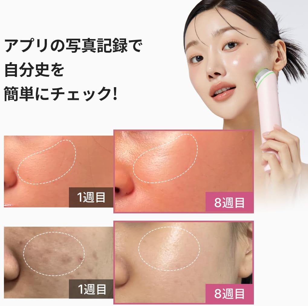 月額4,980円レンタルプラン：メディキューブ AGE-Rブースタープロ 美顔器 JE-GK1L-2OXV