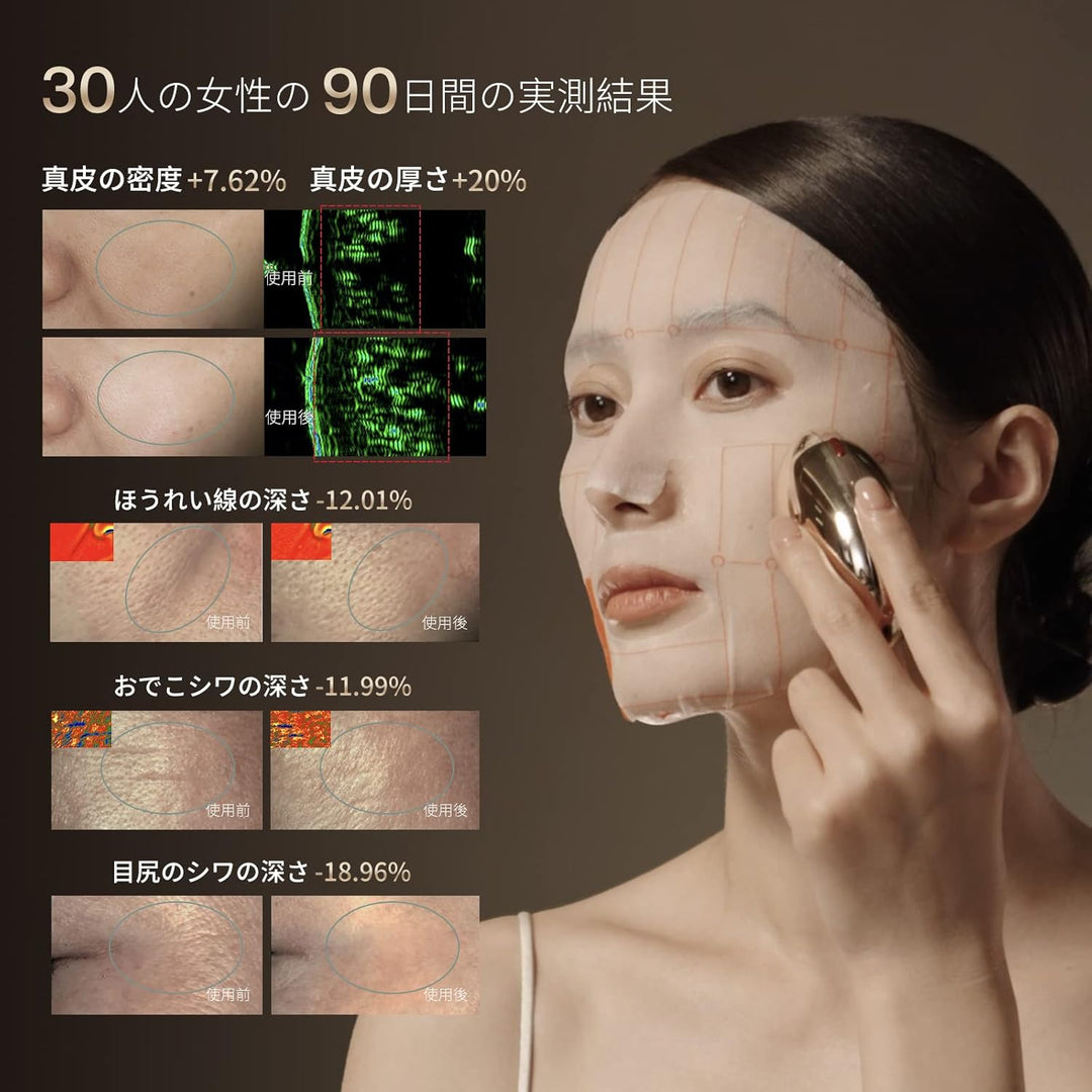 月額5,980円レンタルプラン：AMIRO S1 RF美顔器 EMS ABF202