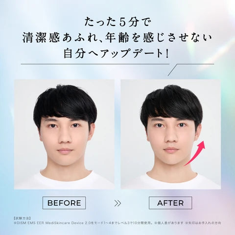 月額8,800円レンタルプラン：ディズム EMS EERメディスキンケアデバイス 2.0 美顔器 EMS BOT-2310-2